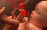 Amnesty International et UNICEF : le tout et son contraire en matière d’avortement