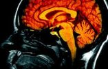 Cerveau : découverte du centre de la conscience