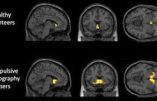 Trop de porno réduit la matière grise du cerveau