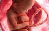 L’utilisation de fœtus pour fabriquer des vaccins ? L’aveu du Dr Plotkin