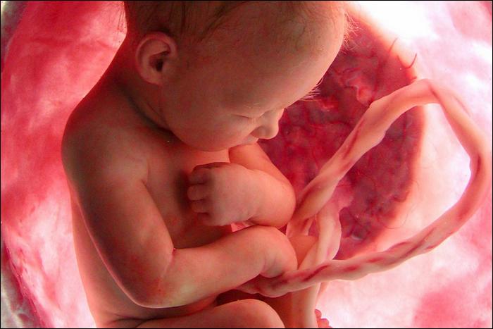 Banalisation de l’avortement et taux de natalité au plus bas dans tout l’Occident Foetus-MPI