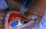 Eyeball Tatoo : le tatouage des yeux, une technique gravement dangereuse