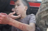 Photo de l’enfant palestinien capturé, torturé et décapité par les amis « modérés » de Hollande, Fabius, Sarkozy, Obama, etc…