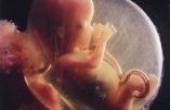 Culture de mort en marche : les députés votent l’allongement de l’avortement à 14 semaines