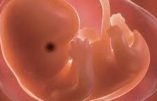Les conséquences pratiques de la révocation de Roe contre Wade: le planning (anti-) familial a déjà cessé de commettre des avortements dans 9 Etats