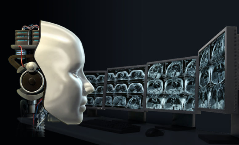 Remplacer les radiologues par l'IA ?