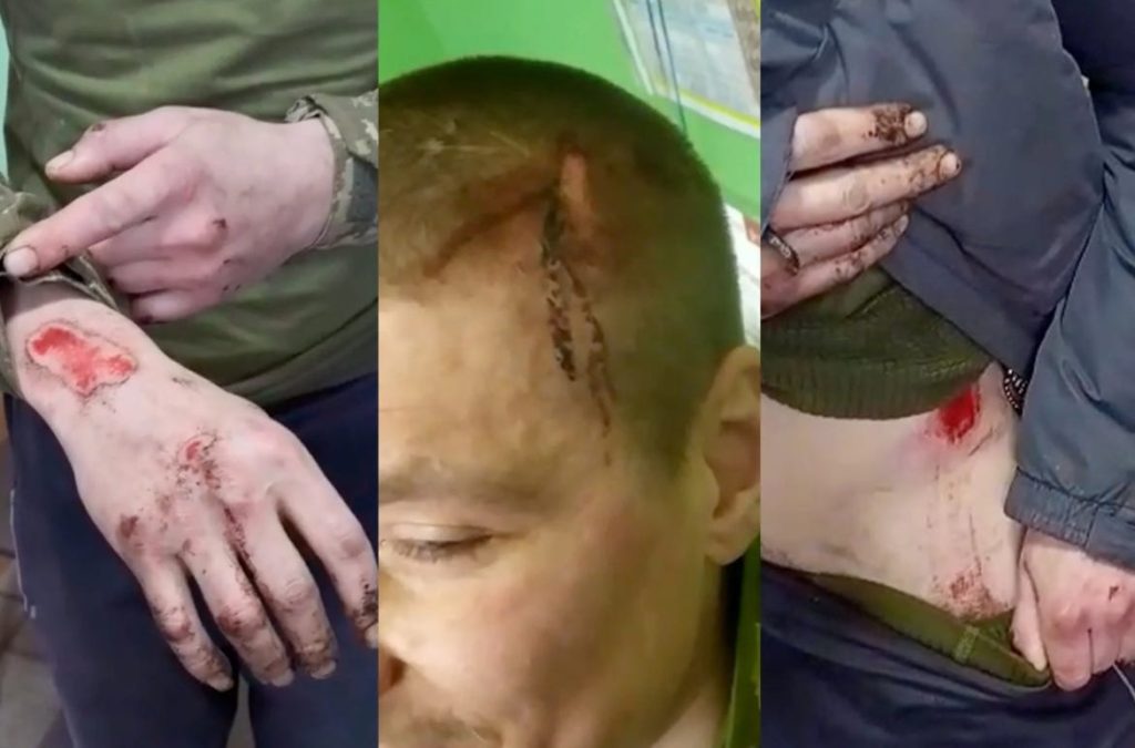 Ukraine : une armée camp de concentration